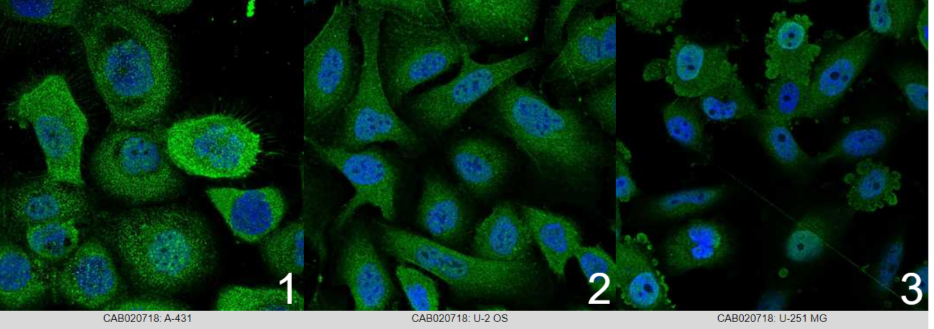 cell_lines.png