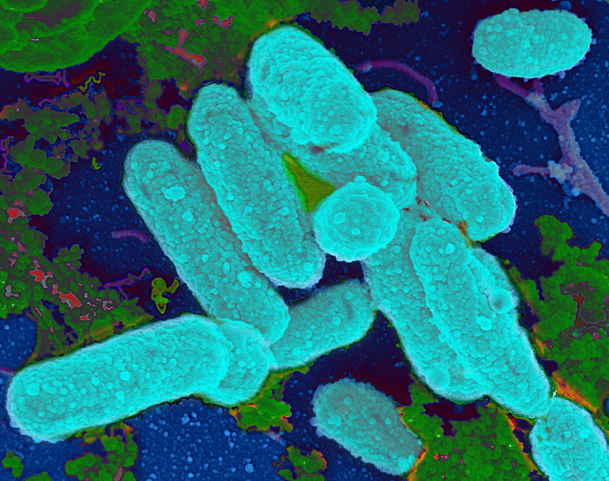 4 заболевания бактериями