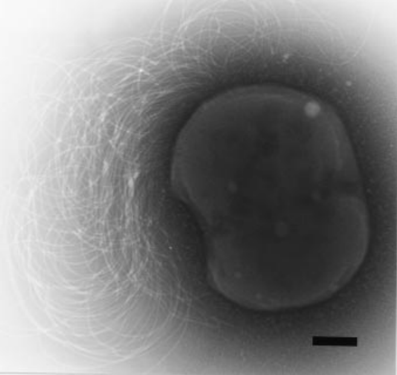 Methanothermococcus okinawensis electron micrograph