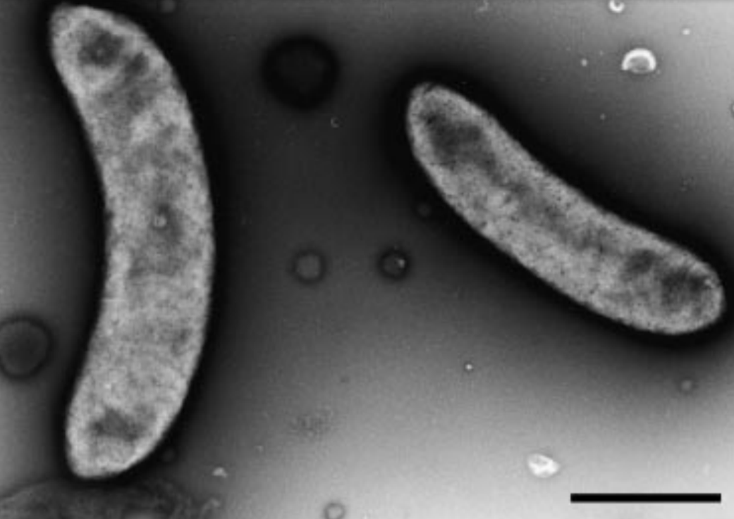 Электронная микрофотография DSM 15288, на которой видна 
					типичная 
					дугообразная форма данных бактерий. Полоса, 1 µm.