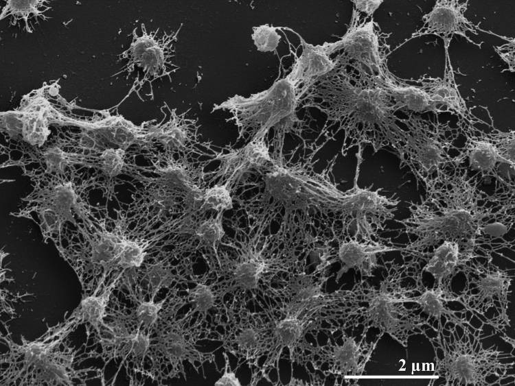 Электронная микрография колонии бактерий штамма 04OKA010-24T