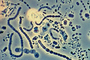 Methanothermobacter thermautotrophicus