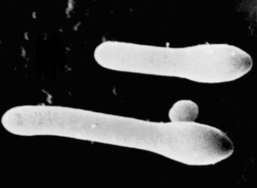 Споры возбудителя столбняка внутри вегетативной клетки