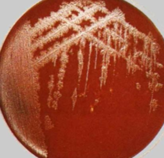 Рост бактерии на кровяном агаре